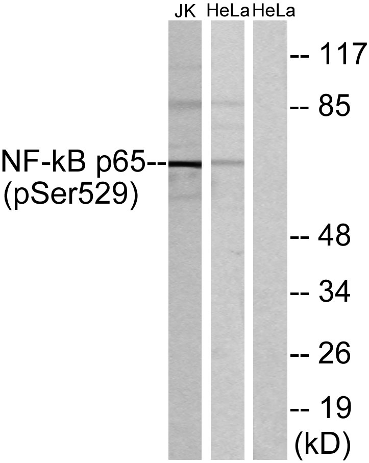 NFκB-p65 (phospho Ser529) Polyclonal Antibody