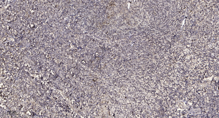 ACAP1 (phospho Ser554) Polyclonal Antibody