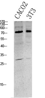 Tau (Phospho Ser396) Antibody