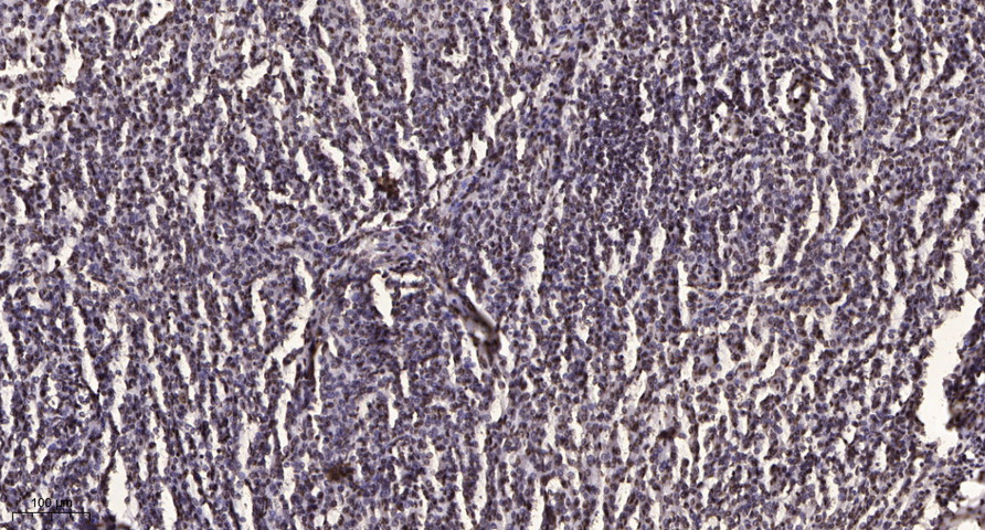 Bamacan (Phospho Ser1083) Polyclonal Antibody