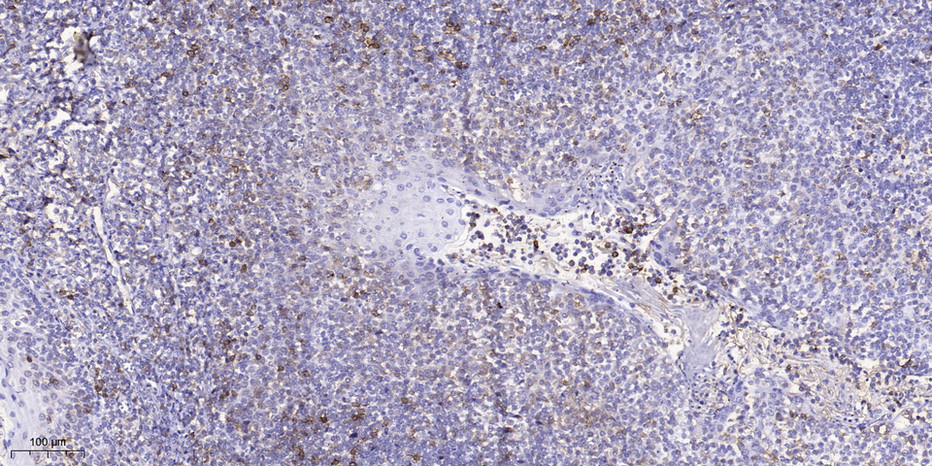 EPHA1 (Phospho Tyr605) Polyclonal Antibody