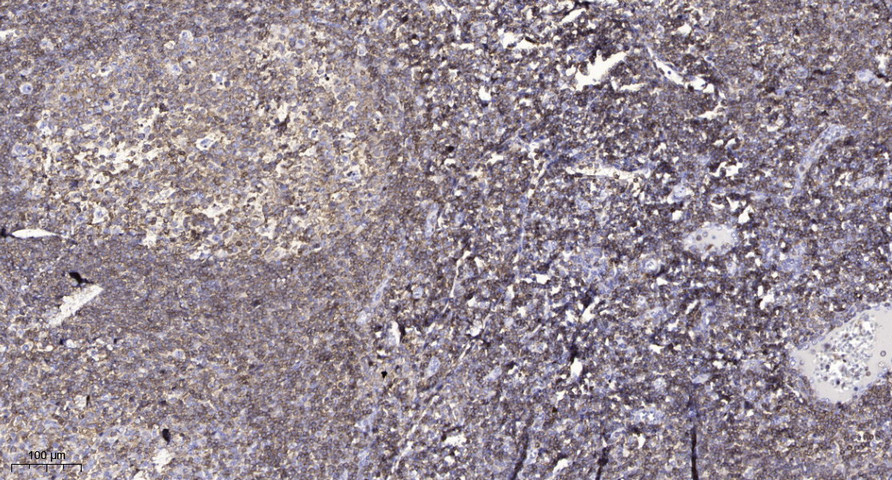 DAPK1 (Phospho Ser308) Polyclonal Antibody