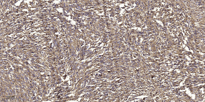 GRK2 (Phospho Tyr86) Polyclonal Antibody