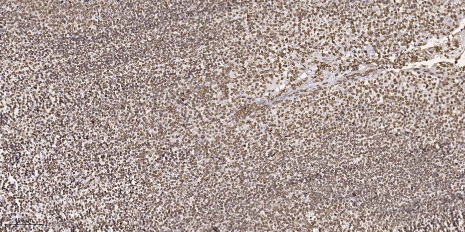 MOK (Phospho Tyr161) Polyclonal Antibody