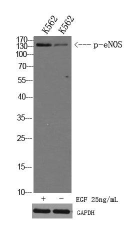 eNOS (Phospho Ser1179) Polyclonal Antibody