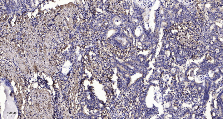 IGF2R (Phospho Ser2484) Polyclonal Antibody