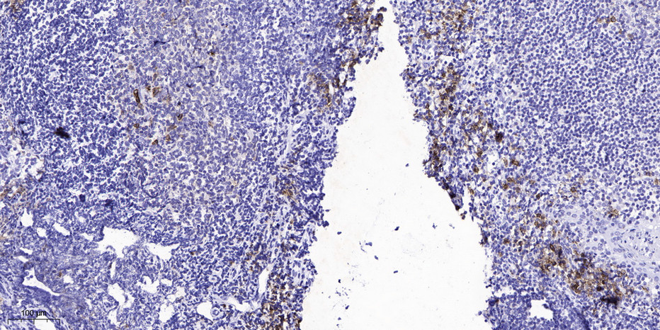 HER2 (Phospho Tyr1139) Polyclonal Antibody