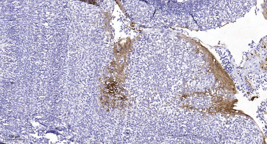 Doublecortin (Phospho Ser378) Polyclonal Antibody
