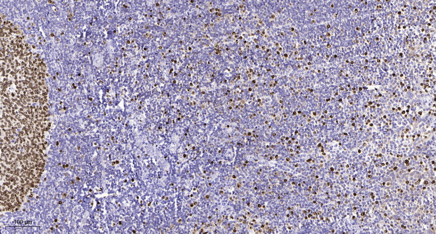 GARNL1 (Phospho S797) Polyclonal Antibody