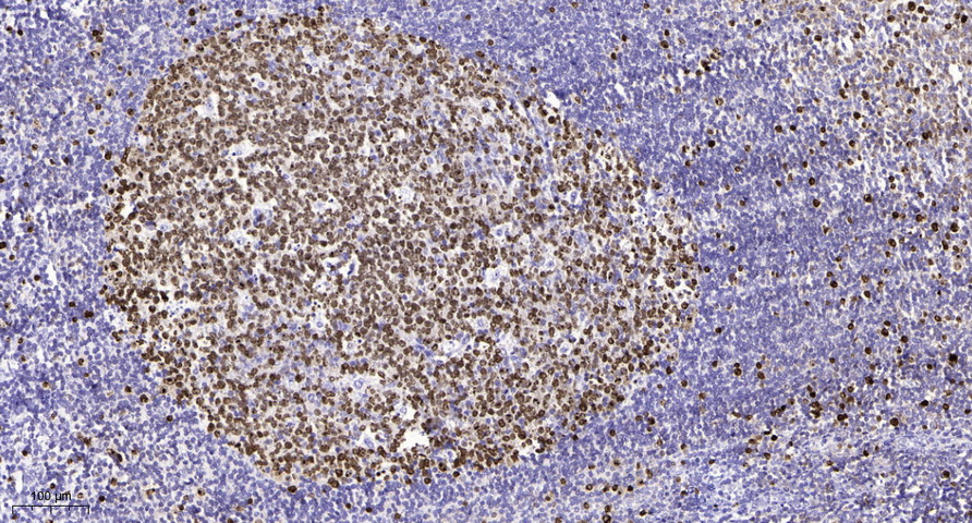 GARNL1 (Phospho T736) Polyclonal Antibody