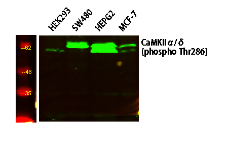 CaMK2 (Phospho Thr286) Antibody
