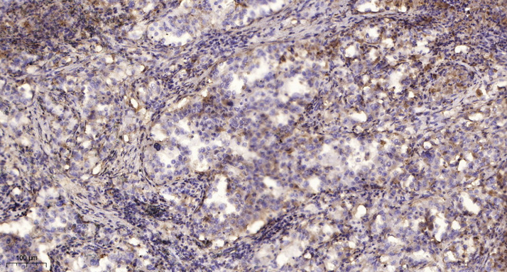 MEK-4 (phospho Ser257) Polyclonal Antibody