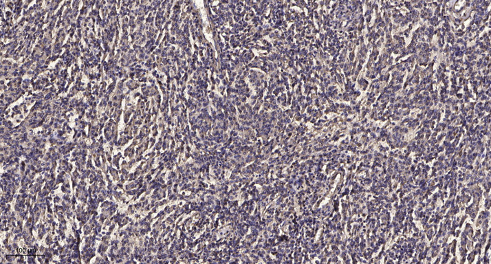 PEPC (Phospho Ser15) Polyclonal Antibody