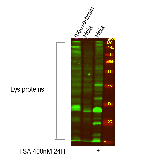 Acetyl Lys proteins Polyclonal Antibody