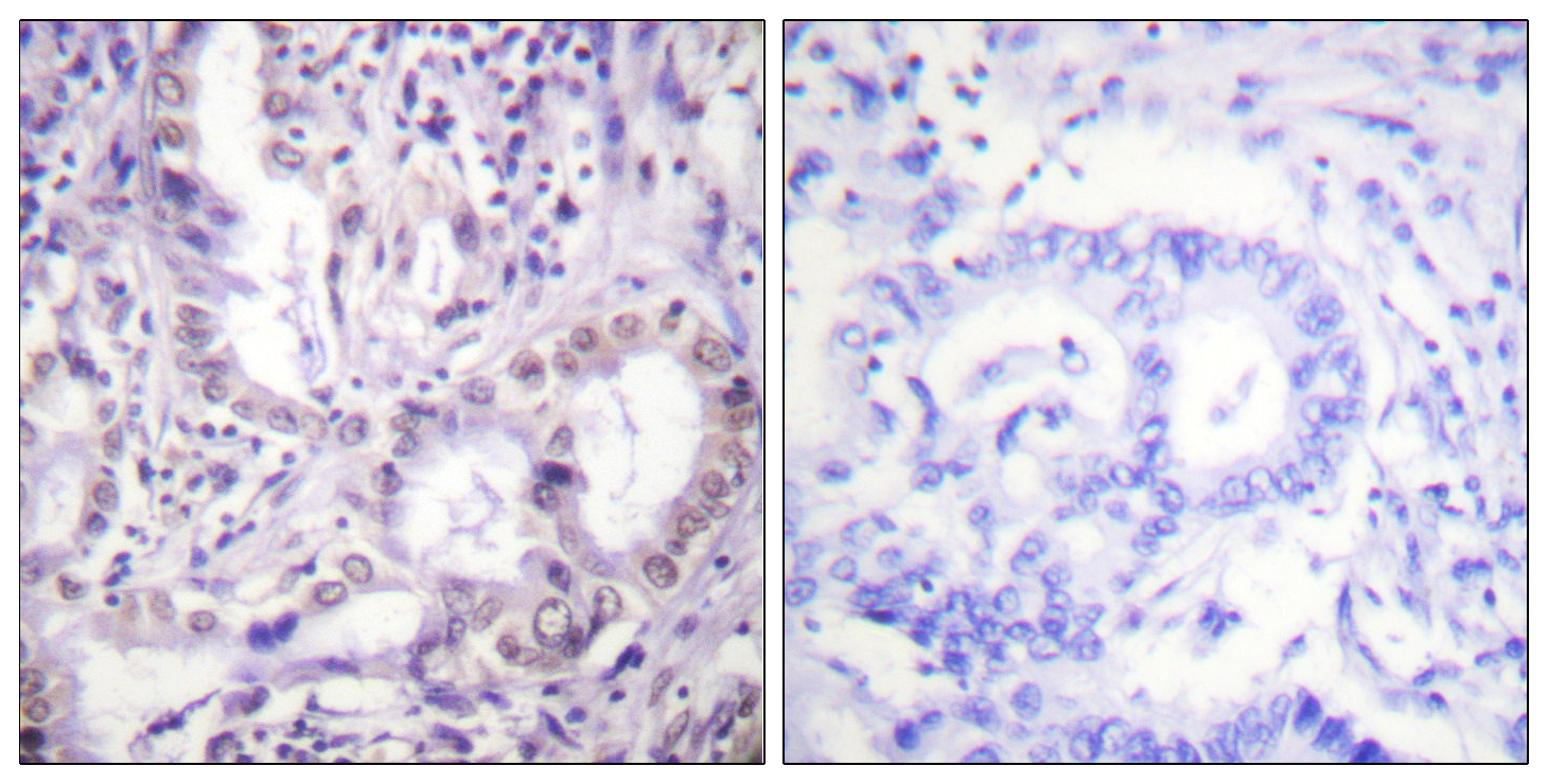 Acetyl Lys proteins Polyclonal Antibody