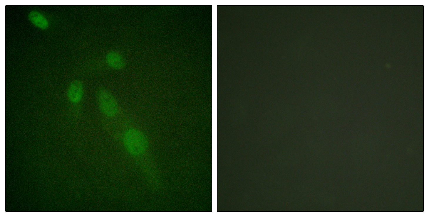 Acetyl Lys proteins Polyclonal Antibody