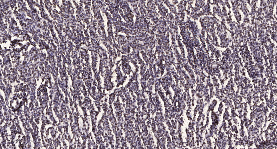 Stat3 (Acetyl-Lys49) Polyclonal Antibody