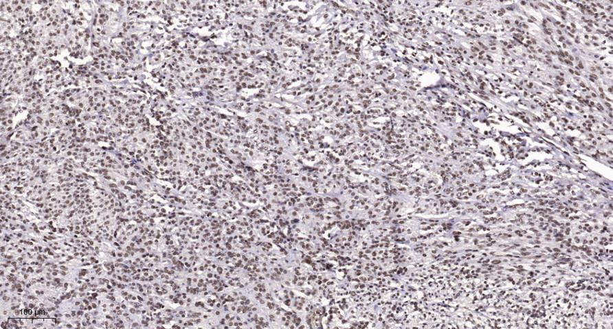 Ku-80 (Acetyl Lys565) Polyclonal Antibody