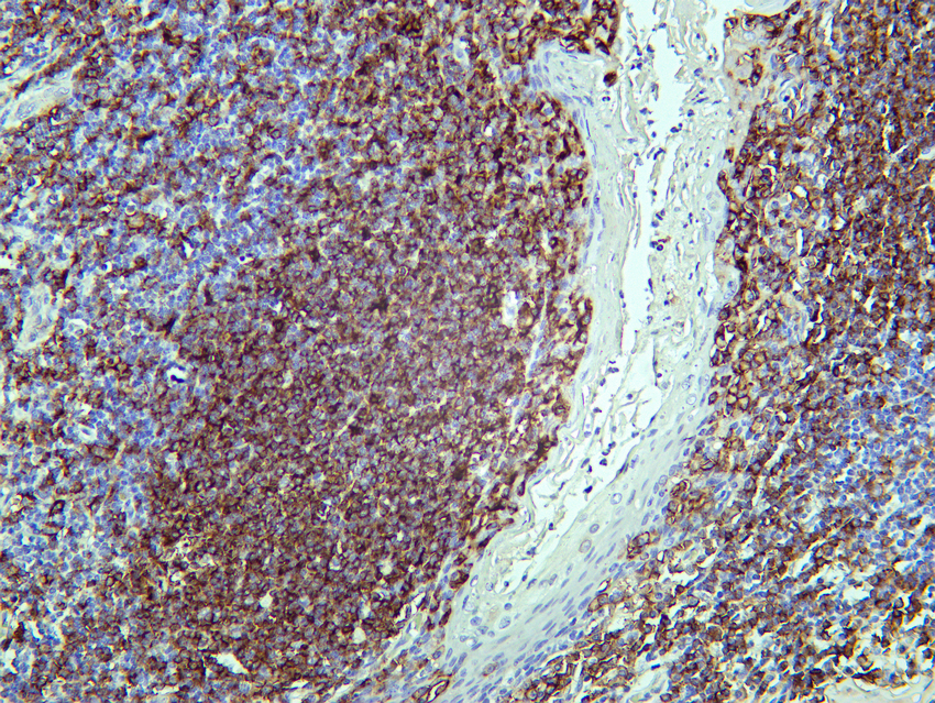CD19 (PT0089R) PT® Rabbit mAb