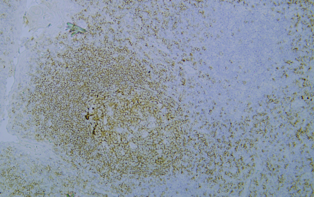 CD19 (PTR2046) mouse mAb