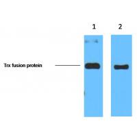 Trx-Tag Monoclonal Antibody5H9