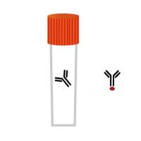 AFP3 Rabbit Polyclonal Antibody
