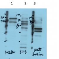 METTL14 Rabbit Polyclonal Antibody