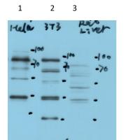 METTL3 Rabbit Polyclonal Antibody