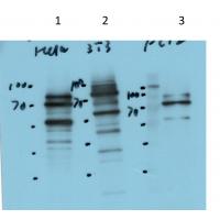 STIM1 Rabbit Polyclonal Antibody