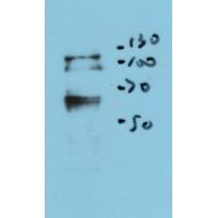 Tetanus toxin Rabbit Polyclonal Antibody