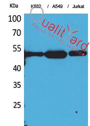  Western Blot analysis of K562, A549, Jurkat cells using Acetyl-Tubulin α (K352) Polyclonal Antibody.. Secondary antibody(catalog#：RS0002) was diluted at 1:20000