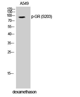 GR (phospho Ser203) Polyclonal Antibody