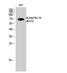  Western Blot analysis of 4T1 cells using Acetyl-Ku-70 (K331) Polyclonal Antibody.. Secondary antibody(catalog#：RS0002) was diluted at 1:20000
