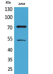  Western Blot analysis of Jurkat cells using Acetyl-Ku-70 (K539) Polyclonal Antibody. Antibody was diluted at 1:500. Secondary antibody(catalog#：RS0002) was diluted at 1:20000
