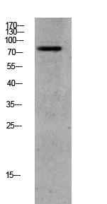 GRK2 (Phospho-Ser685) Antibody
