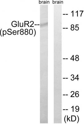  Western blot analysis of lysates from mouse brain, using GluR2 (Phospho-Ser880) Antibody. The lane on the right is blocked with the phospho peptide.