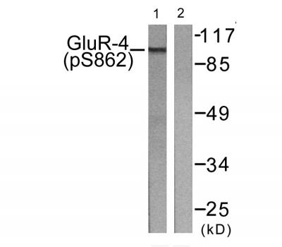  Western blot analysis of lysates from HepG2 cells treated with Forskolin 40nM 30', using GluR4 (Phospho-Ser862) Antibody. The lane on the right is blocked with the phospho peptide.