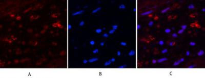  Immunofluorescence analysis of Human-appendix tissue. 1,HAO1 Monoclonal Antibody(Mix)(red) was diluted at 1:200(4°C,overnight). 2, Cy3 labled Secondary antibody was diluted at 1:300(room temperature, 50min).3, Picture B: DAPI(blue) 10min. Picture A:Target. Picture B: DAPI. Picture C: merge of A+B