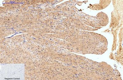  Immunohistochemical analysis of paraffin-embedded Mouse-heart tissue. 1,HAO1 Monoclonal Antibody(Mix) was diluted at 1:200(4°C,overnight). 2, Sodium citrate pH 6.0 was used for antibody retrieval(>98°C,20min). 3,Secondary antibody was diluted at 1:200(room tempeRature, 30min). Negative control was used by secondary antibody only.