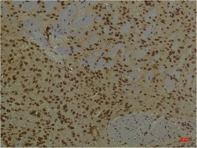  Immunohistochemical analysis of paraffin-embedded Mouse BrainTissue using HIF-1 β/ARNT Mouse mAb diluted at 1:200.