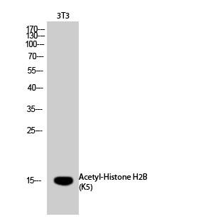  Western Blot analysis of 3T3 cells using Acetyl-Histone H2B (K5) Polyclonal Antibody diluted at 1：1000. Secondary antibody(catalog#：RS0002) was diluted at 1:20000