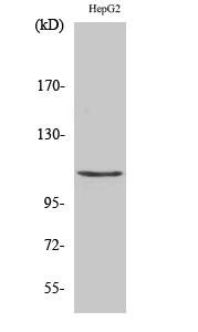  Western Blot analysis of HepG2 cells using Histone deacetylase 9 Polyclonal Antibody diluted at 1：1000