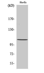 Histone deacetylase 7a Polyclonal Antibody