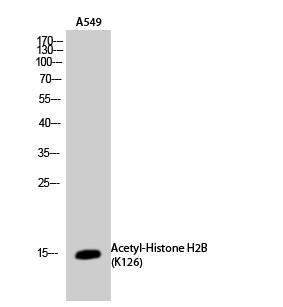  Western Blot analysis of A549 cells using Acetyl-Histone H2B (K126) Polyclonal Antibody. Secondary antibody(catalog#：RS0002) was diluted at 1:20000
