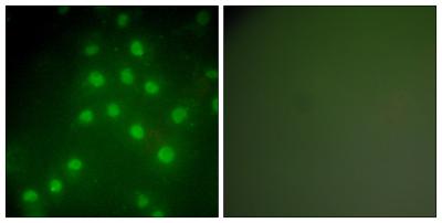  Immunofluorescence analysis of HepG2 cells, using HDAC9 Antibody. The picture on the right is blocked with the synthesized peptide.
