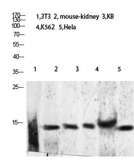 Histone H2B (Acetyl-Lys24/25) Polyclonal Antibody