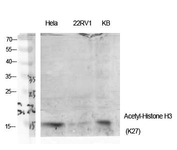 Histone H3 (Acetyl Lys27) Polyclonal Antibody
