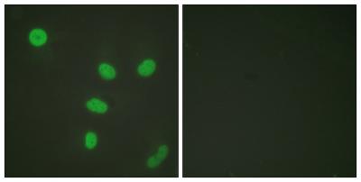 Immunofluorescence analysis of HeLa cells, using Histone H3 (Acetyl-Lys27) Antibody. The picture on the right is blocked with the synthesized peptide.