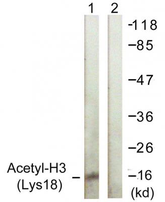  Western blot analysis of lysates from HeLa cells, treated with TSA 400nM 24h, using Histone H3 (Acetyl-Lys18) Antibody. The lane on the right is blocked with the synthesized peptide.