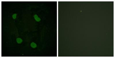  Immunofluorescence analysis of HeLa cells, using Histone H3 (Acetyl-Lys14) Antibody. The picture on the right is blocked with the synthesized peptide.